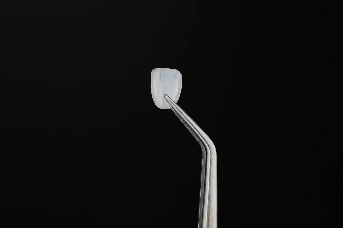 Dental Veneers